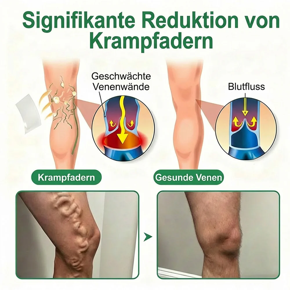 👨‍⚕️🔥Healrize® VeinEase Mikronadel-Technologie⚡Spürbare Wirkung in Tagen – nachhaltige Verbesserung - Image 4