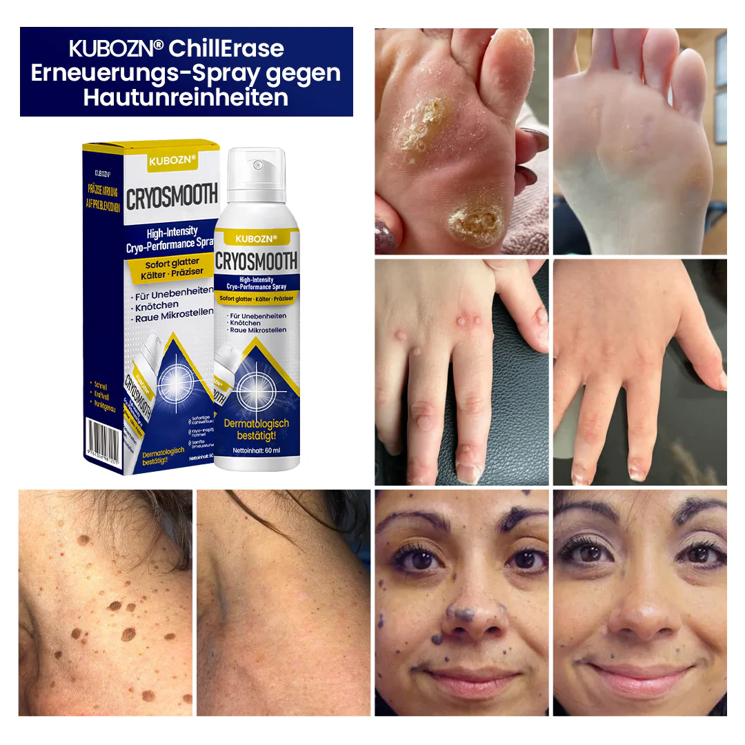 ⭐ KUBOZN® ChillErase – Präzisions-Pflegespray gegen Unebenheiten & kleine Hautknötchen (OFFER) - Image 2