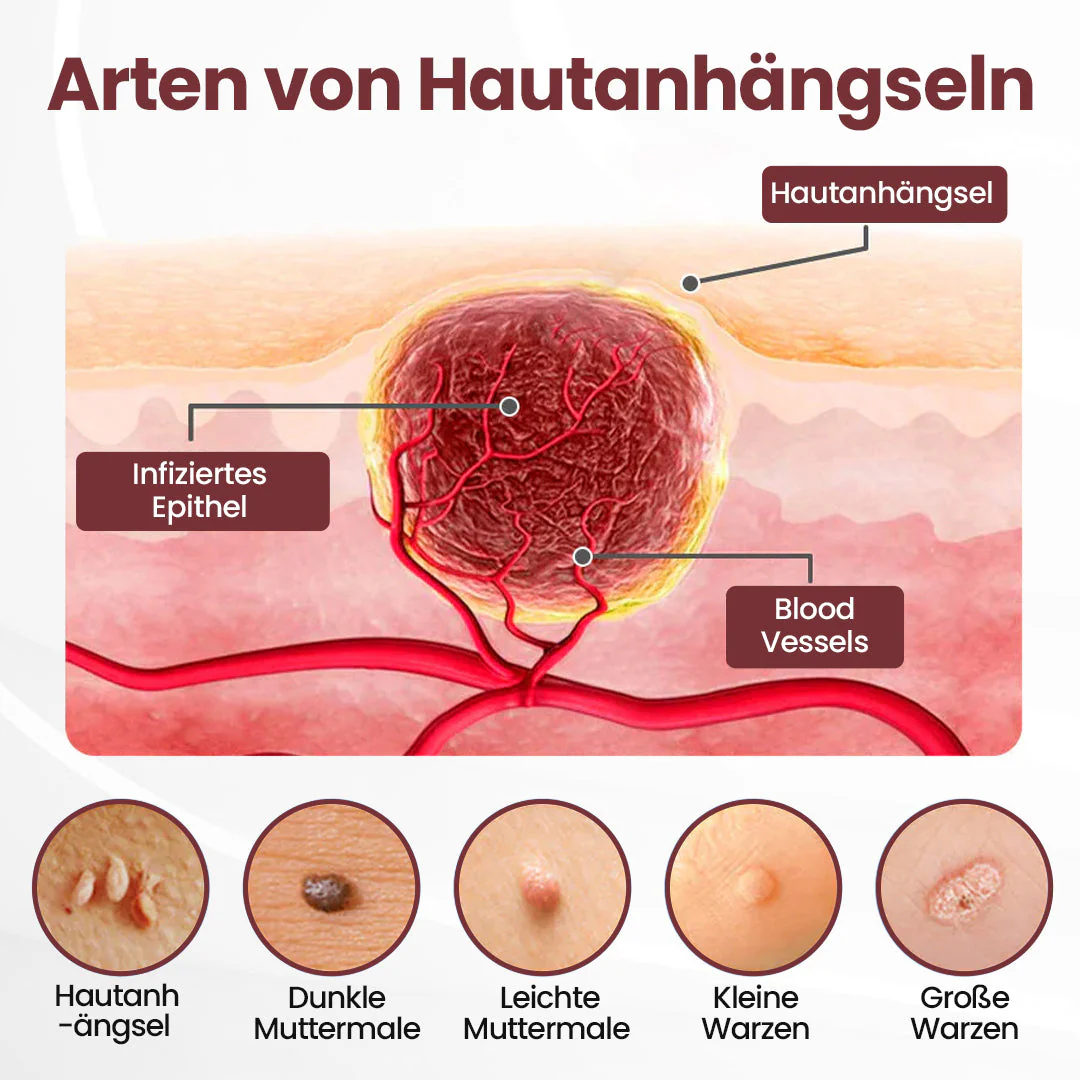 ⭐ KUBOZN® OryzaClear – Schwarzreis-Extrakt Creme gegen Hautanhänge & raue Stellen – sanft, pflanzlich & sichtbar wirksam  🅱︎ - Image 3