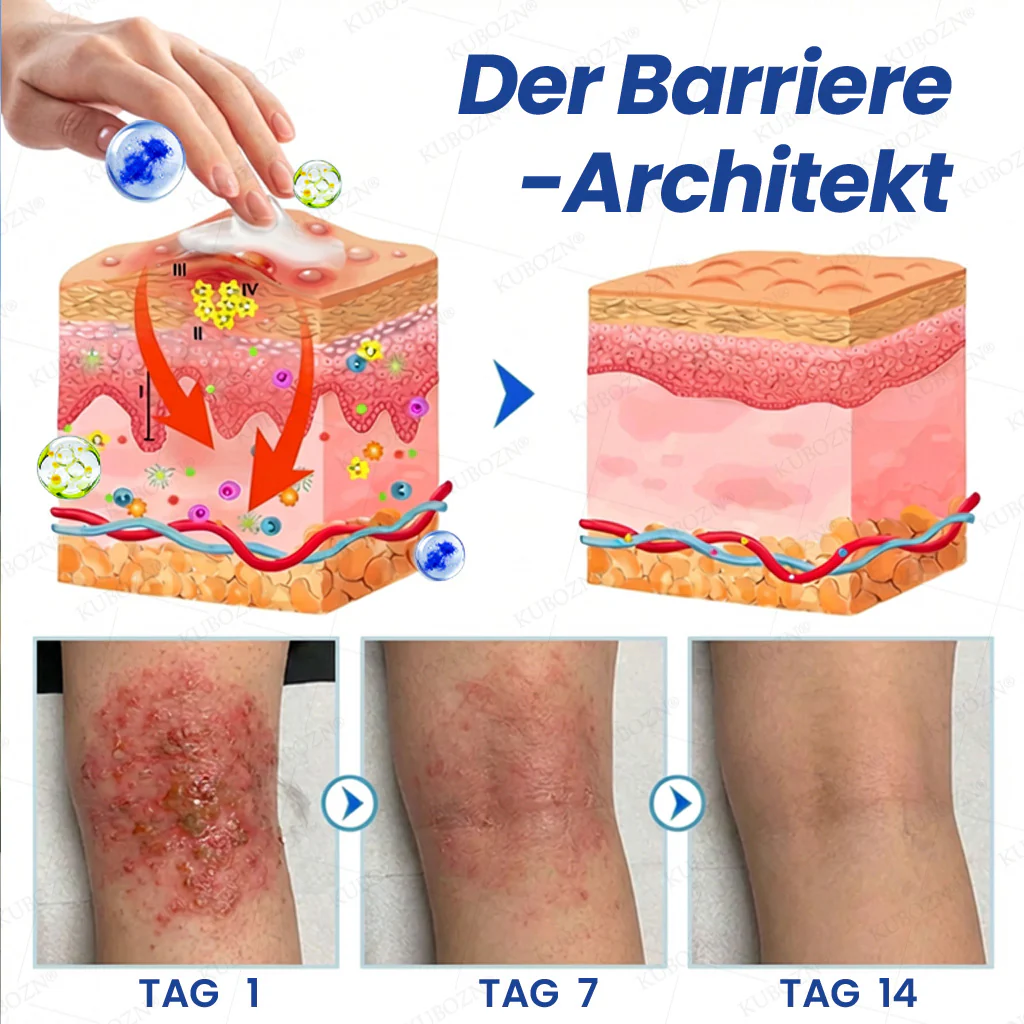 KUBOZN® Eczem & Neurodermitis Set – 24h Pflege bei Juckreiz, Rötungen & geschädigter Haut - Image 3
