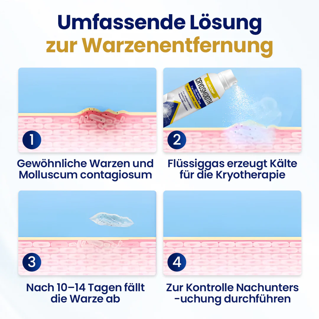 ⭐ KUBOZN® ChillErase – Präzisions-Pflegespray gegen Unebenheiten & kleine Hautknötchen - Image 4