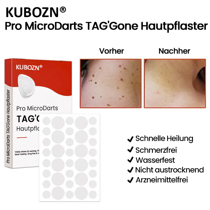 KUBOZN® Pro MicroDarts TAG'Gone Hautpflaster zur Skin-Tag-Entfernung 🅱︎ - Image 2