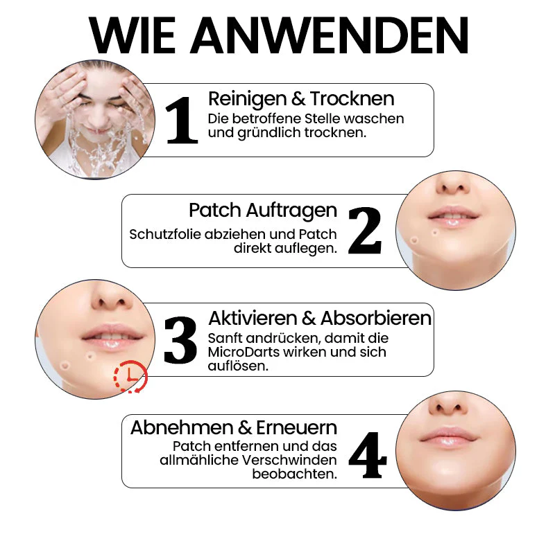 KUBOZN® Pro MicroDarts TAG'Gone Hautpflaster zur Skin-Tag-Entfernung 🅱︎ - Image 3