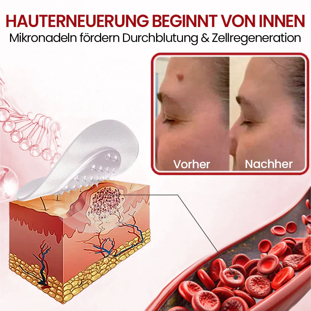 ⭐ KUBOZN® Mikronadel-Pflaster – 2026 optimierte Formel gegen Hautanhängsel & Warzen 🅱︎ - Image 3